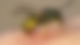 Wespe sticht in die Haut